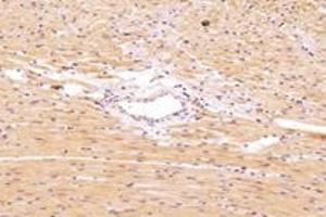 Immunohistochemistry analysis of paraffin-embedded rat heart using,PSKH1 (ABIN7075291) at dilution of 1: 2800