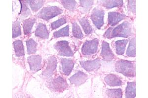 Anti-BDKRB2 / BK-2 antibody immunocytochemistry (ICC) staining of untransfected HEK293 human embryonic kidney cells.