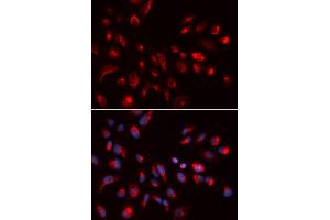 Immunofluorescence (IF) image for anti-Cholinergic Receptor, Muscarinic 5 (CHRM5) antibody (ABIN1876555) (CHRM5 anticorps)