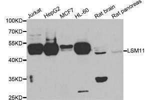 Western blot analysis of extracts of various cell lines, using LSM11 antibody. (LSM11 anticorps)