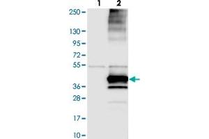 Western blot analysis of Lane 1: Negative control (vector only transfected HEK293T lysate). (KCNK17 anticorps)