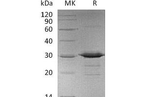 Western Blotting (WB) image for Adiponectin (ADIPOQ) protein (His tag) (ABIN7320468) (ADIPOQ Protein (His tag))