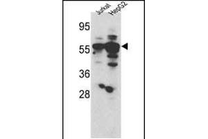 Western blot analysis of hSGKL- (SGK3) (ABIN1882132 and ABIN2842051) in Jurkat and HepG2 cell line lysates (35 μg/lane). (SGK3 anticorps  (AA 108-139))