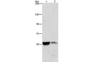 Western Blot analysis of Mouse liver and kidney tissue using ALDH8A1 Polyclonal Antibody at dilution of 1:550 (ALDH8A1 anticorps)