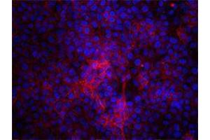 Immunofluorescence (IF) image for anti-CD47 (CD47) antibody (ABIN2664729) (CD47 anticorps)