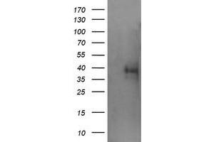 Image no. 2 for anti-Tripartite Motif Containing 44 (TRIM44) antibody (ABIN1501507) (TRIM44 anticorps)