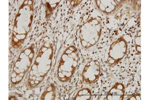 Image no. 1 for anti-Elongator Complex Protein 1 (ELP1) (AA 1242-1332) antibody (ABIN599043) (IKAP/p150 anticorps  (AA 1242-1332))