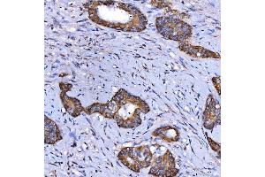 IHC analysis of SARS2 using anti-SARS2 antibody (ABIN7601804). (SARS2 anticorps  (AA 46-518))