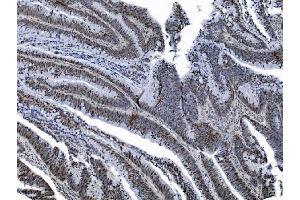 IHC analysis of MCM6 using anti-MCM6 antibody (ABIN7600036). (MCM6 anticorps  (AA 14-821))