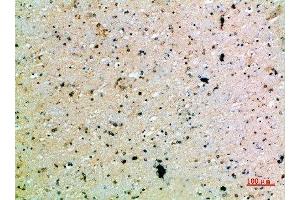 Immunohistochemical analysis of paraffin-embedded human-brain, antibody was diluted at 1:200