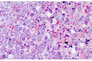 Anti-IL-17 antibody IHC staining of human t lymphocytes.
