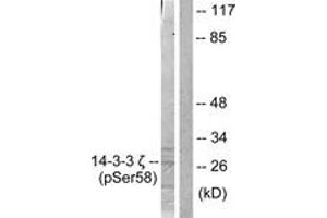 Western blot analysis of extracts from NIH-3T3 cells treated with UV 30', using 14-3-3 zeta (Phospho-Ser58) Antibody. (14-3-3 zeta anticorps  (pSer58))
