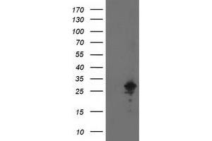 Western Blotting (WB) image for anti-Adenylate Kinase 4 (AK4) antibody (ABIN1496525) (AK4 anticorps)