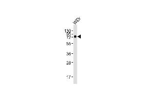 Anti-CD73 (NT5E) Antibody (C-term) at 1:2000 dilution + WiDr whole cell lysates Lysates/proteins at 20 μg per lane. (CD73 anticorps)
