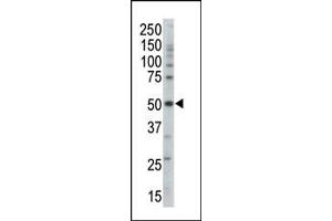 Western blot analysis of anti-PRKAG3 Pab (ABIN391060 and ABIN2841215) in mouse brain tissue lysate.