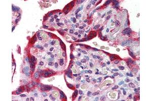 Anti-ABCB4 antibody IHC of human placenta.