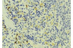 ABIN6273178 at 1/100 staining Human lymph tissue by IHC-P.