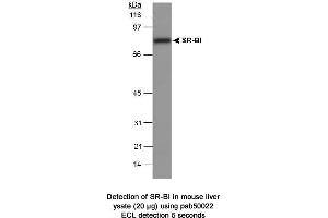 Image no. 1 for anti-Scavenger Receptor Class B, Member 1 (SCARB1) (C-Term) antibody (ABIN363331) (SCARB1 anticorps  (C-Term))