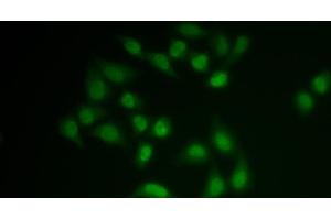 Immunofluorescence analysis of MCF-7 cells using CHAT Polyclonal Antibody (Choline Acetyltransferase anticorps)