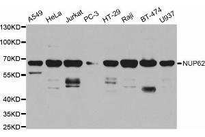 Western blot analysis of extracts of various cell lines, using NUP62 antibody. (NUP62 anticorps  (AA 403-522))