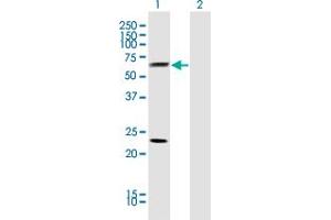 Western Blot analysis of CLU expression in transfected 293T cell line by CLU monoclonal antibody (M01), clone 1A11.