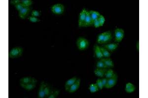 Immunofluorescence staining of HepG2 cells with ABIN7153741 at 1:105, counter-stained with DAPI.