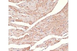 Immunohistochemistry of paraffin-embedded Mouse heart using ADRA1A Polyclonal Antibody at dilution of 1:100 (40x lens). (alpha 1 Adrenergic Receptor anticorps)