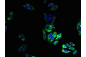 Immunofluorescent analysis of HepG2 cells using ABIN7172859 at dilution of 1:100 and Alexa Fluor 488-congugated AffiniPure Goat Anti-Rabbit IgG(H+L)