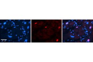 Rabbit Anti-Pou3f3 Antibody  Catalog Number: ARP57888_P050 Formalin Fixed Paraffin Embedded Tissue: Human Adult heart  Observed Staining: Nuclear Primary Antibody Concentration: 1:600 Secondary Antibody: Donkey anti-Rabbit-Cy2/3 Secondary Antibody Concentration: 1:200 Magnification: 20X Exposure Time: 0.