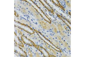 Immunohistochemistry of paraffin-embedded mouse kidney using COG2 antibody. (COG2 anticorps  (AA 1-280))