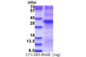 SDS-PAGE (SDS) image for Hepatocyte Growth Factor (Hepapoietin A, Scatter Factor) (HGF) (AA 32-285) protein (ABIN5853753) (HGF Protein (AA 32-285))