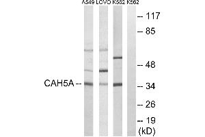 Western blot analysis of extracts from A549 cells, LOVO cells and K562 cells, using CA5A antibody.