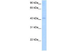 WB Suggested Anti-AADAC Antibody Titration:  2. (AADAC anticorps  (C-Term))
