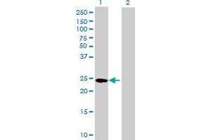 Western Blot analysis of GSTA4 expression in transfected 293T cell line by GSTA4 MaxPab polyclonal antibody. (GSTA4 anticorps  (AA 1-222))