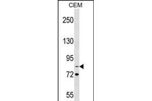 ITGB2 Antibody (N-term) (ABIN1539259 and ABIN2849614) western blot analysis in CEM cell line lysates (35 μg/lane). (Integrin beta 2 anticorps  (N-Term))