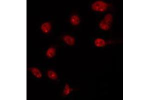 ABIN6266723 staining HT29 by IF/ICC. (T-Box 10 anticorps  (Internal Region))
