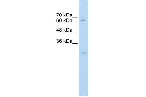 Carboxylesterase 2 antibody used at 0. (CES2 anticorps)
