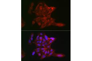 Immunofluorescence analysis of U-2 OS cells using LOX Rabbit pAb (ABIN6133805, ABIN6143288, ABIN6143289 and ABIN6223629) at dilution of 1:100 (40x lens). (LOX anticorps)
