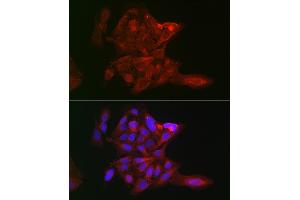 Immunofluorescence analysis of U-2 OS cells using LOX Rabbit pAb (ABIN6133805, ABIN6143288, ABIN6143289 and ABIN6223629) at dilution of 1:100 (40x lens).