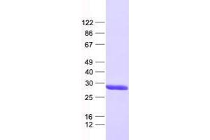 Validation with Western Blot