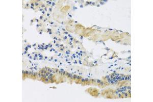 Immunohistochemistry of paraffin-embedded mouse lung using CLIP1 antibody (ABIN5975170) at dilution of 1/100 (40x lens). (CLIP1 anticorps)