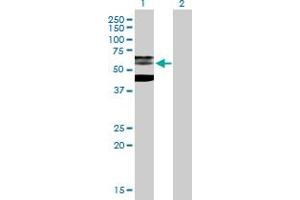 Western Blot analysis of PHF21B expression in transfected 293T cell line by PHF21B MaxPab polyclonal antibody. (PHF21B anticorps  (AA 1-531))