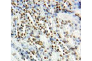 IHC-P analysis of Kidney tissue, with DAB staining. (Vitamin D Receptor anticorps  (AA 266-422))