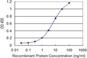 Detection limit for recombinant GST tagged TWIST1 is 0.