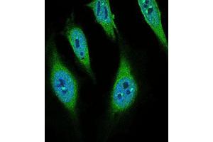 Immunofluorescence analysis of Hela cells using CD68 mouse mAb (green).