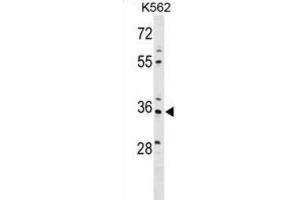 Western Blotting (WB) image for anti-PDZ and LIM Domain 4 (PDLIM4) antibody (ABIN2999859) (PDLIM4 anticorps)