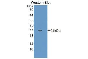 Detection of Recombinant ZG16B, Human using Polyclonal Antibody to Zymogen Granule Protein 16 Homolog B (ZG16B) (ZG16B anticorps  (AA 53-208))