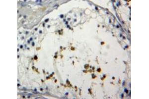 Used in DAB staining on fromalin fixed paraffin-embedded Testis tissue