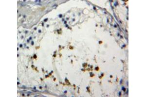 Used in DAB staining on fromalin fixed paraffin-embedded Testis tissue (FOXP1 anticorps  (AA 461-671))