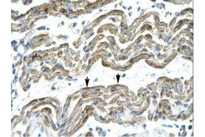 Image no. 1 for anti-Zinc Finger Protein 828 (ZNF828) (AA 261-310) antibody (ABIN202924)